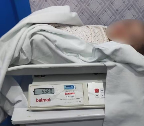 MAOS TRATO EM CRIANÇA: Mãe usa maquiagem para esconder marcas de agressão e abandono de bebê em Mato Grosso