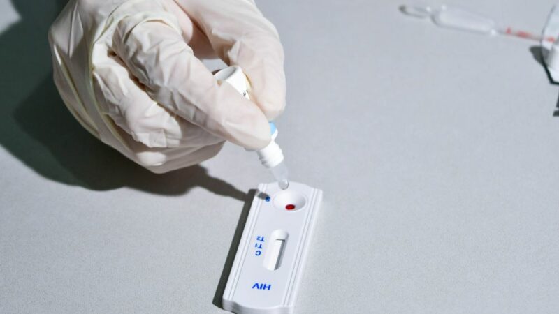 Prefeitura de Cuiabá intensifica ações de prevenção ao HIV e combate ao preconceito