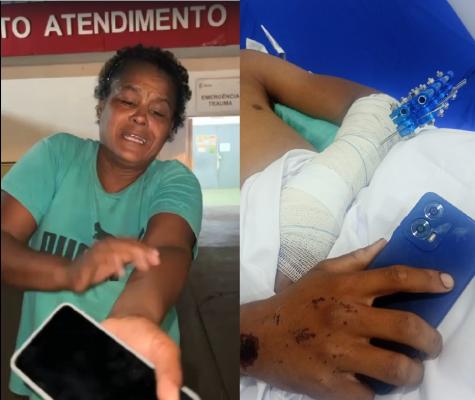 Adolescente com larvas em ferimento após acidente em MT